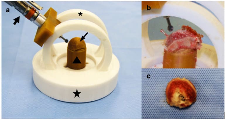 Printed donor acetabular cutting jig